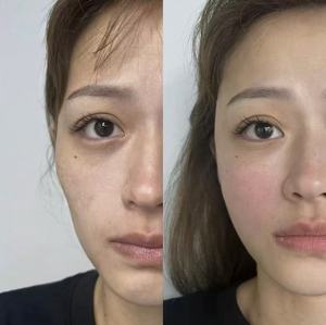 KXY Peptitleri Özlü Cilt Onarım Profesyonel Yüz Bakımı Liofilize Toz Yüz Kolajeni Onarır Yüz Kırışıklıklarını Azaltır - Product Image 2