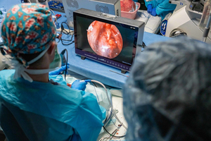 <span class=keywords><strong>Ikeda</strong></span> YKD-9122 kỹ thuật số xách tay nội soi Hệ thống camera với màn hình cho tối thiểu xâm lấn phẫu thuật - Product Image 6