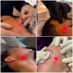 980nm 1470nm Diode Laser endolifting Máy lipolysis | chai chanh tiêm | sculptra BBL mông phụ | GLP-1 giảm béo - Product Image 3