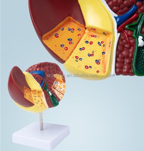 Mô hình giải phẫu gan bệnh lý của con người cho trường Y để nghiên cứu và nghiên cứu về đặc điểm gan bệnh lý - Product Image 5