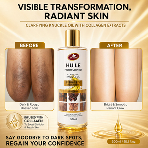 Huile Essentielle Clarifiante au Collagène Bio OEM ODM 300ml – Huile Éclaircissante <span class=keywords><strong>Anti</strong></span>-Taches pour Genoux, Coudes et Doigts Sombres - Product Image 3