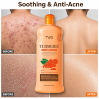 TWG OEM Soins Corporels Marque Privée Lotion Corporelle Éclaircissante au Curcuma Unifie le Teint Hydratation Profonde Non Collante Ensemble de Lotions Corporelles Blanchissantes