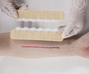 Dispositivo Médico para Cierre de Heridas, Adhesivo Quirúrgico Zip Stitch, Cierre con Cremallera, Desinfección por Infrarrojos Lejanos, Certificado CE Clase I Liderson PZF1006 - Product Image 6