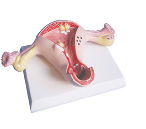 Geavanceerde pvc Vrouwelijke Interne Genitale orgel anatomisch Model - Product Image 4