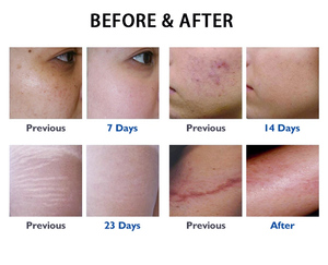 Nuevo Dispositivo Portátil 4D <span class=keywords><strong>de</strong></span> CO2 Fraccionado 2026 para Rejuvenecimiento <span class=keywords><strong>de</strong></span> <span class=keywords><strong>la</strong></span> Piel, Tensado Vaginal, Enfriamiento Facial, Blanqueamiento y Limpieza Facial - Product Image 3