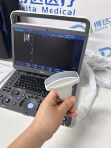 Ecógrafo Veterinario Portátil en Blanco y Negro Sonoscope E1V para Equinos, Caballos, Vacas y Ovejas con Sonda Rectal, Disponible en Stock, Listo para Enviar para Ranchos - Product Image 4