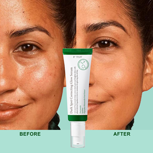 特注有機ナイアシンアミド美白化抗暗点補正血清フェイスホワイトニング & 活性化色素除去剤 - Product Image 4