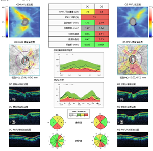 Retiview-500 gambar yang baik dan perangkat lunak analisis teknik pencitraan resolusi tinggi mesin tomografi orgasme optik Okt - Product Image 5