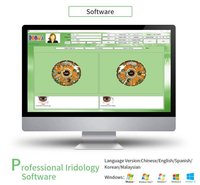 Цифровой анализатор Iriscope 12 МП с программным обеспечением
