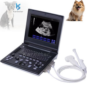 <span class=keywords><strong>Ultrasound</strong></span> Scan B Scan generasi baru dilengkapi dengan berbagai fungsi praktis sistem <span class=keywords><strong>Ultrasound</strong></span> - Product Image 1