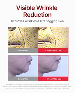 Sản phẩm chăm sóc da Hàn Quốc centellian24 madeca Kem Thời gian đảo ngược 50ml - Product Image 3