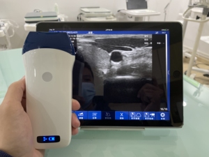 Sonde linéaire sans fil DMU37 à 128 éléments, la plus vendue, avec Doppler couleur pour MSK/Anesthésie/Vascularisation et Hôpitaux - Product Image 2