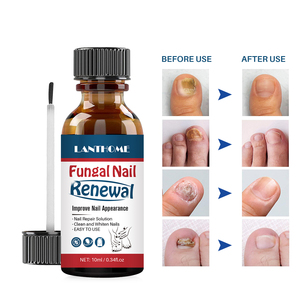 LANTHOME 10ml soluzione di riparazione delle unghie pulisci sbiancare nutrire le unghie trattamento delle unghie fungine trattamento dei funghi dell'unghia del piede - Product Image 3