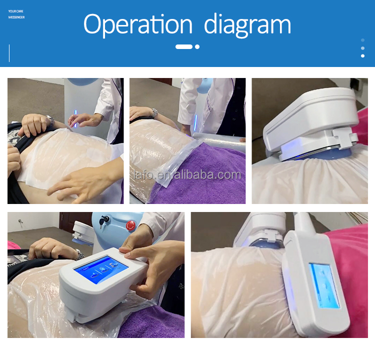 Newest portable 2 cryo handles 360 cryolipolysis machine for body slimming double chin removal