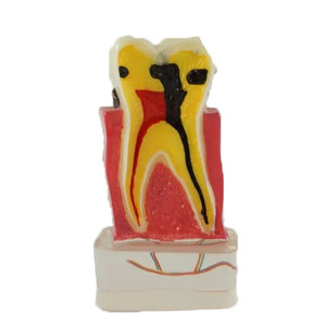 Modelo de Dentes 4 Vezes para Doença Periodontal Modelo de Dentes Humanos Modelo de Educação em Ciências Médicas - Product Image 1