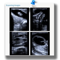 Échographe vétérinaire pour bovins, ovins et équidés, avec sonde linéaire rectale pour l'échographie abdominale et l'évaluation de la graisse dorsale