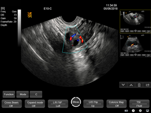 Sistem <span class=keywords><strong>Ultrasound</strong></span> profesional PT50A/C: menggabungkan portabilitas, pencitraan Digital penuh, dan kinerja yang andal. - Product Image 6