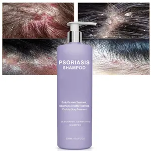 Couro cabeludo Psoríase Tratamento Shampoo Dermatite seborreica Foliculite Caspa Seco Coceira Scalp Hair Wash