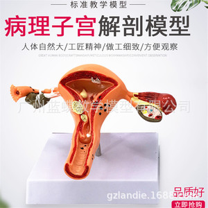 Modèle d'utérus humain, aide pédagogique, moule de simulation vaginale et ovarienne, anatomie, pathologie, simulation médicale féminine, modèle de reproduction féminine - Product Image 5