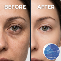 OEM ODM GHK-CU Niacinamide Eye Patches Under Eye Mask Reduce Dark Circles Puffy Eyes Undereye Bags Wrinkles Gel Gifts for Women