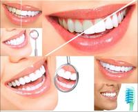 Facettes Dentaires Blanchissantes, Faux Appareil Dentaire Temporaire, Faux Dents, Appareil de Sourire Parfait, Kit de Facettes Dentaires Confortables