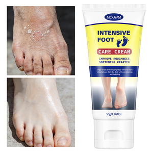 Crème hydratante et baume pour les pieds à <span class=keywords><strong>base</strong></span> <span class=keywords><strong>d</strong></span>'urée, hydratation intensive pour les pieds et talons secs et rugueux, vente en gros - Product Image 1