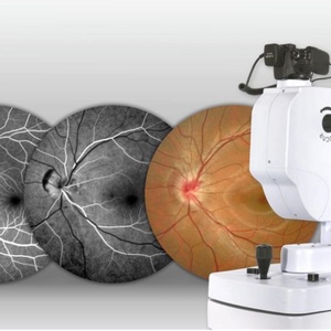 Caméra de fond d'œil non mydriatique - Appareil d'imagerie du fond d'œil FFA haute résolution avec modes de flash dynamique et lumière bleue YDC09 - Product Image 2