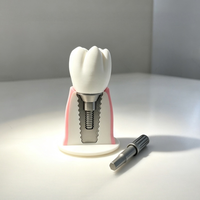 Modèle de structure d'implant dentaire détachable avec vis et poteau, modèle d'affichage dentaire agrandi pour l'apprentissage des étudiants