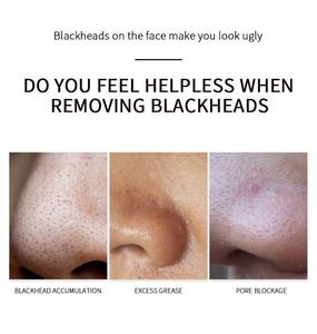 Masker Wajah kupas pemurni Pori, masker penghilang komedo dengan asam salisilat Aloe Pembersih pori-pori tanah liat putih Amazonian - Product Image 5