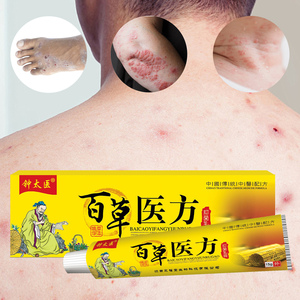 Crema hidratante antipruriginosa para la piel, crema herbal para <span class=keywords><strong>hongos</strong></span> y psoriasis, ungüento para alergias cutáneas - Product Image 1