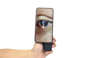 Nouvelle Lampe à Fente Numérique Ophthalmique Ultra-Portable à Main, Compatible Smartphone, Grossissement 6X - Prix - Product Image 2