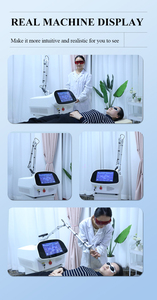 Producto en Tendencia 2026, Máquina de Eliminación de Pigmentos con Láser Picosegundo Q-switch 1064 532nm, Limpieza Facial con Carbón, Blanqueamiento, Eliminación de Tatuajes - Product Image 6