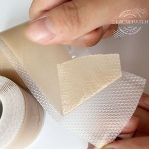 Chuancheng Meilleures ventes <span class=keywords><strong>Rouleau</strong></span> de ruban adhésif en silicone portable pour cicatrices chirurgicales, chéloïdes, hypertrophiques et rides - Product Image 2