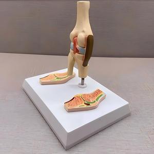 Modelo de Articulación de Rodilla con Artritis Reumatoide - Herramienta Educativa de <span class=keywords><strong>Ortopedia</strong></span> - Product Image 3
