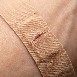 Yoniner YN-BA CE Certificato MDR, Bende Adesive in Tessuto Elastico di Classe Medica I, Colore Pelle, Traspiranti, Resistenti all'Acqua, <span class=keywords><strong>per</strong></span> Pronto Soccorso - Product Image 2