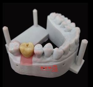 Prothèses dentaires d'<span class=keywords><strong>implant</strong></span> adaptées au système d'implantation traditionnel en <span class=keywords><strong>zircone</strong></span> ou couronne Pfm à des <span class=keywords><strong>prix</strong></span> abordables - Product Image 1
