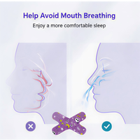 Bandelettes buccales jetables pour le sommeil, bandes respiratoires pour usage nocturne, certifiées CE, non électriques, classe I, en tissu non tissé doux et respirant