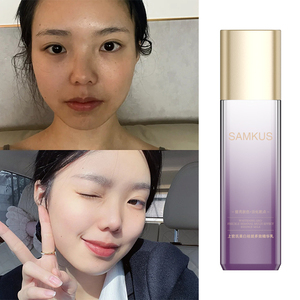 Lait d'essence multi-effets éclaircissant et anti-taches OEM/ODM pour le <span class=keywords><strong>soin</strong></span> du <span class=keywords><strong>visage</strong></span> féminin, éclaircissant et anti-imperfections - Product Image 6