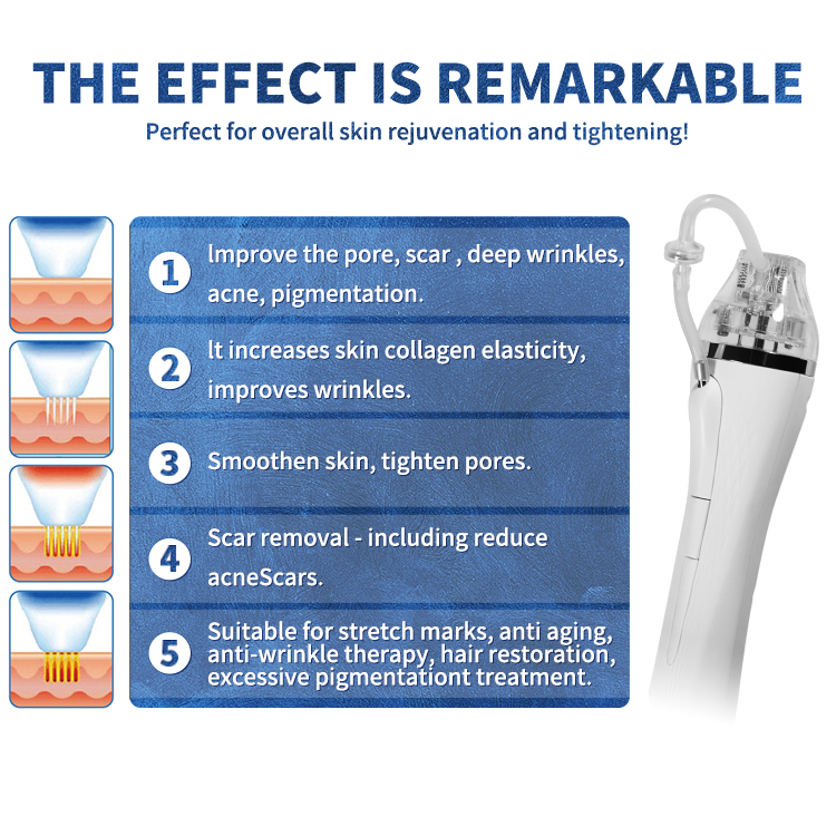 2022 New Technology MMFU 3D 4D 6D 7D HIFU Former 12 Lines 20000shots Machine Face Lifting Anti-wrinkle Microneedle RF