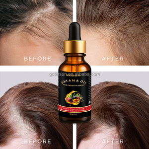 Logotipo personalizado Tratamiento de aceite de Batana orgánico Promueve el crecimiento del cabello Reparación hidratante Conjunto de cuidado del cabello dañado para el crecimiento del cabello - Product Image 5