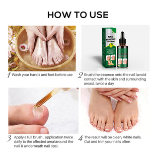 Soins des ongles nourrissants en profondeur, vente en gros, à base de plantes, blanchissant, apaisant, ingrédients contre l'inconfort, <span class=keywords><strong>meilleur</strong></span> <span class=keywords><strong>traitement</strong></span> contre les mycoses des ongles - Product Image 6