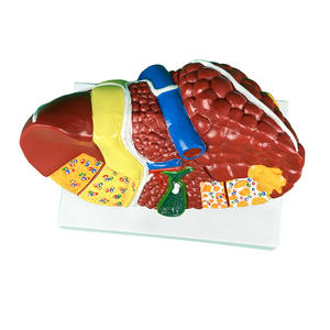 Modèle d'anatomie hépatique pathologique Structure hépatique malade avec cirrhose et lésions tumorales pour l'enseignement médical et la formation chirurgicale - Product Image 4