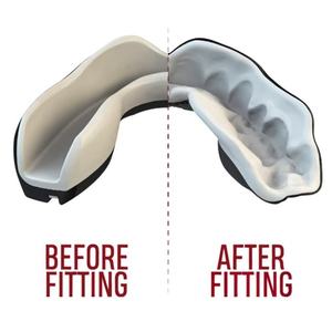 Protector <span class=keywords><strong>bucal</strong></span> deportivo de grado <span class=keywords><strong>profesional</strong></span>: ofrece una protección cómoda y un cuidado <span class=keywords><strong>bucal</strong></span> dedicado para los atletas - Product Image 6