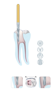 Ensemble de Fresas Rotatives en NiTi pour Canaux Radiculaires, Instruments d'Endodontie pour Nettoyage et Modelage, Outils Dentaires en Nickel-Titane Thermiquement Traité - Product Image 3