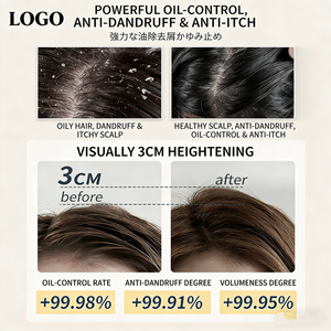 Shampoo agli Aminoacidi OEM per Rafforzare le Radici <span class=keywords><strong>dei</strong></span> <span class=keywords><strong>Capelli</strong></span>, Nutrire il Cuoio Capelluto, Prevenire la Caduta e Favorire la Crescita <span class=keywords><strong>dei</strong></span> <span class=keywords><strong>Capelli</strong></span> Deboli, Uso Quotidiano - Product Image 3