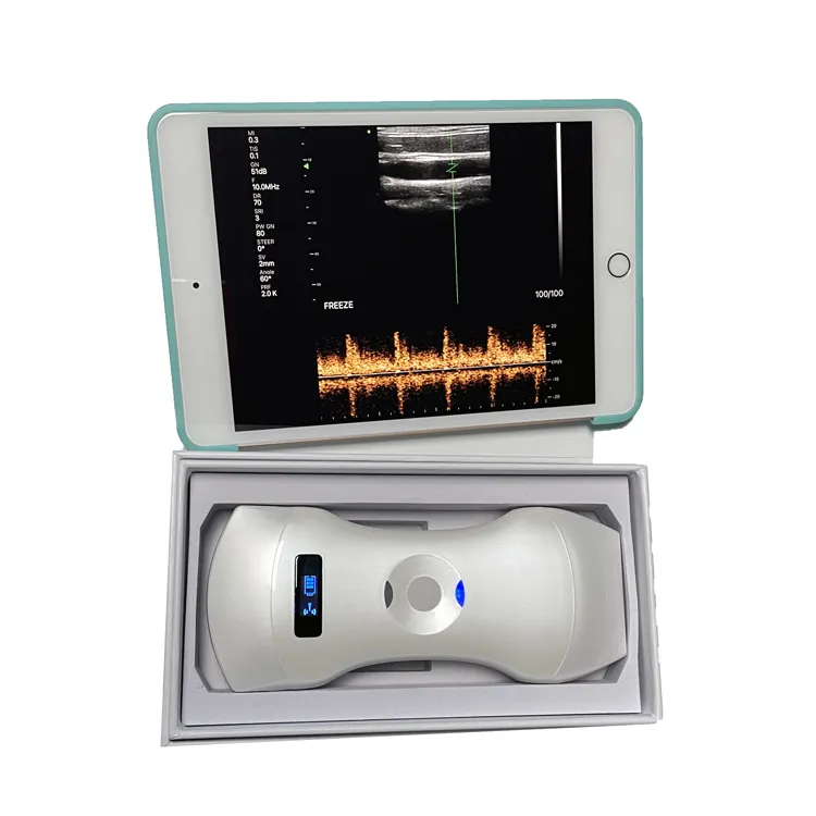 Tıbbi renkli Doppler ultrason aletleri 3 in 1 kablosuz fazlı dizi kardiyak ve doğrusal ve transvajinal/endokavite ve dışbükey