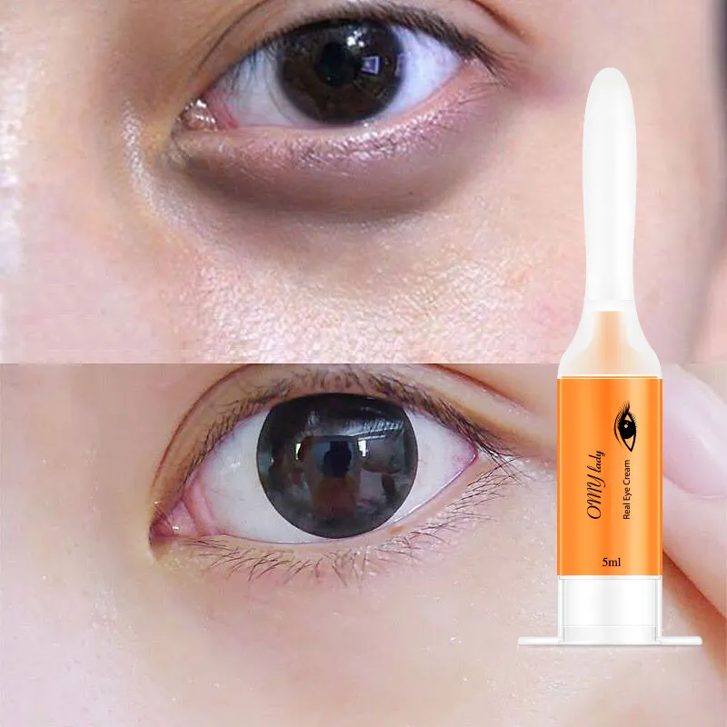 En iyi satış ürünleri OEM/ODM parlatma omy lady göz kremi koyu göz çember sökücü anında kırışıklıklar pürüzsüzleştirici yüz kremi
