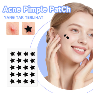 Patchs Hydrocolloï<span class=keywords><strong>des</strong></span> Anti-Acné Black Star Certifiés CE, Autocollants Invisibles pour Imperfections, Guérison Rapide, Marque Privée OEM pour Marques de <span class=keywords><strong>Beauté</strong></span> - Product Image 1