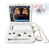 Appareil d'échographie médical portable pour humains, grand écran de 15 pouces, approuvé CE ISO, Mindray DP-20 DP-50