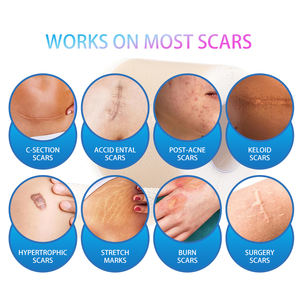 Rollos de láminas de silicona avanzadas para cicatrices, parches de gel de silicona de grado médico para cicatrices - Product Image 2